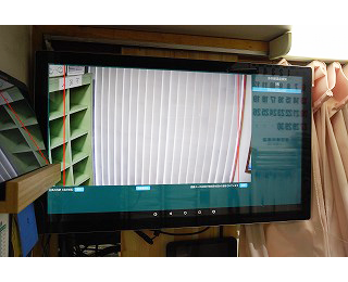 小林歯科医院　モニター